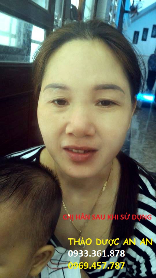 Thảo Dược An An